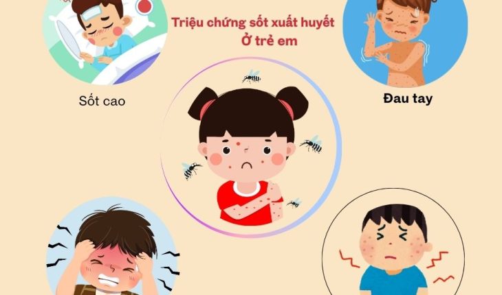 Triệu chứng sốt xuất huyết ở trẻ em và cách điều trị sốt xuất huyết tại nhà