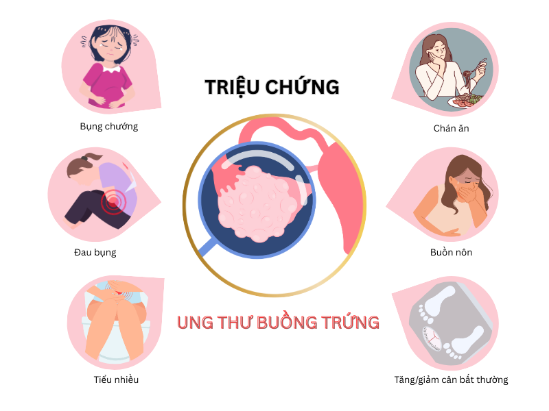 trieu-chung-ung-thu-buong-trung