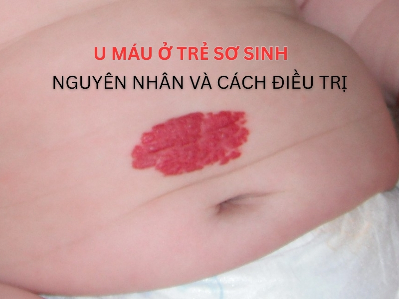 u-mau-o-tre-so-sinh